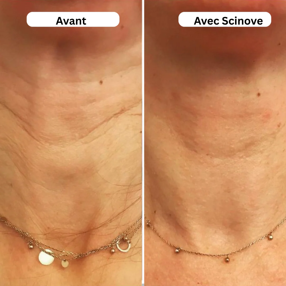 Scinove Micro-Infuseur Pro™